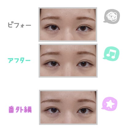 TWOOL ダブルアイリッドグルー/SHOBIDO/二重まぶた用アイテムを使ったクチコミ(3枚目)