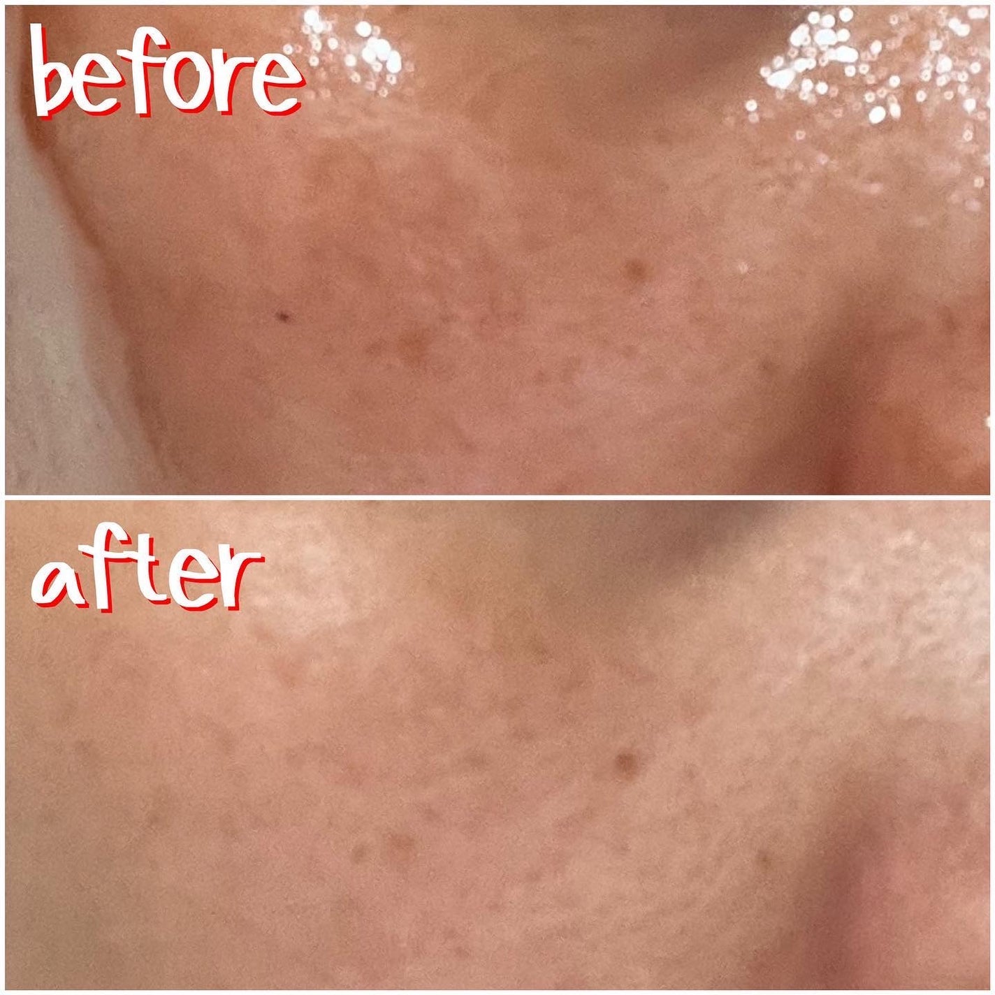 ブラックマグマ ホットクレンジングジェル/ロゼット/クレンジングジェルを使ったクチコミ(4枚目)