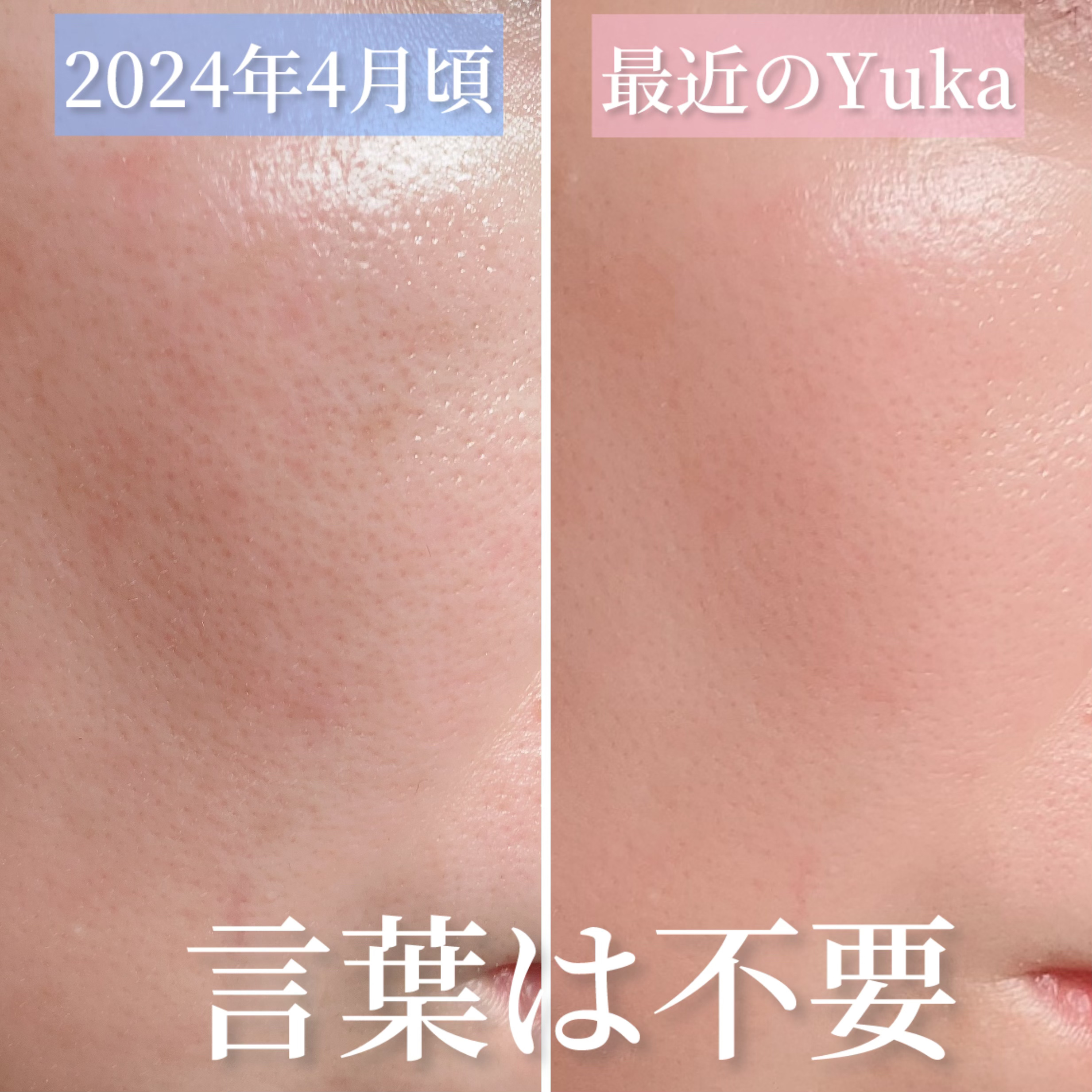 パンテショット675/COSNORI/美容液を使ったクチコミ（2枚目）