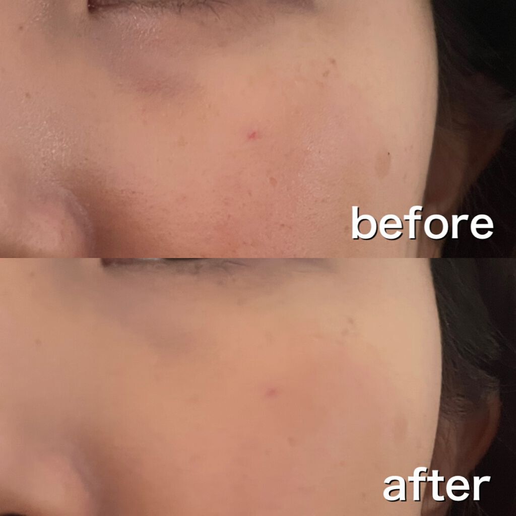 ダブル ウェア ステイ イン プレイス メークアップ /ESTEE LAUDER/リキッドファンデーションを使ったクチコミ（2枚目）