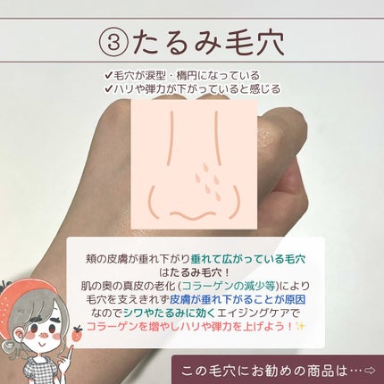 薬用しみ対策 美白化粧水/メラノCC/化粧水を使ったクチコミ(7枚目)