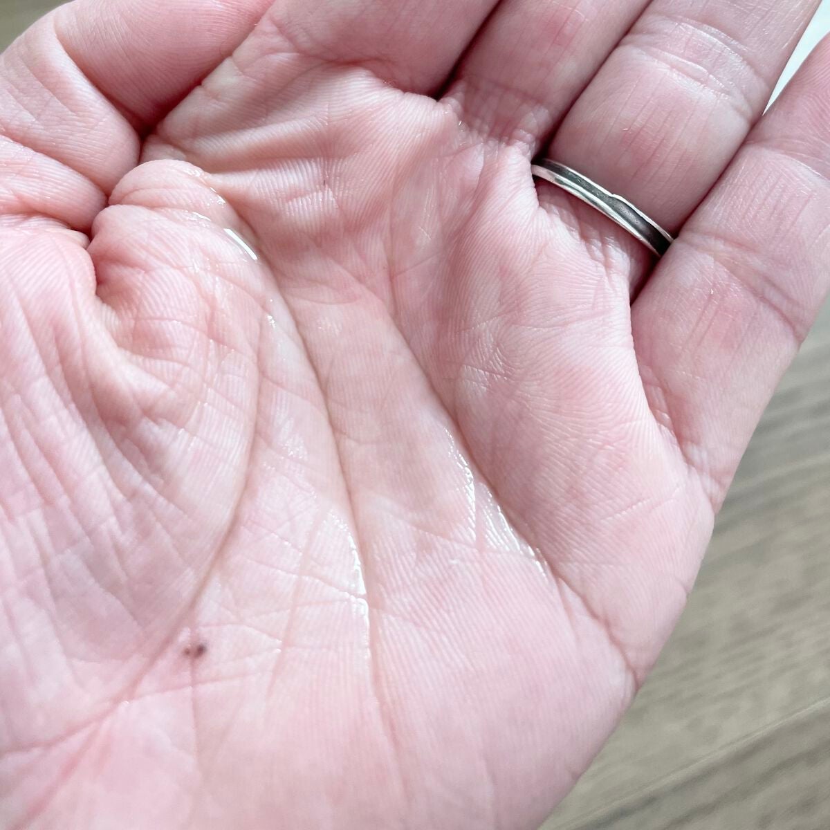 コスメジタン 薬用ヘアマジカエッセンス /シーヴァ/頭皮ローションを使ったクチコミ(3枚目)