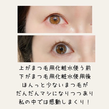 24アイミスト/24Aqua beauty/ミスト状化粧水を使ったクチコミ(6枚目)