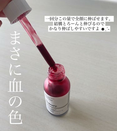 The Ordinary AHA 30% + BHA 2% Peeling Solutionのクチコミ「
˗ˏˋ あの有名な 血みどろピーリング 🩸 ˎˊ˗




私の最近の肌の１番の悩みは

『.....」（2枚目）