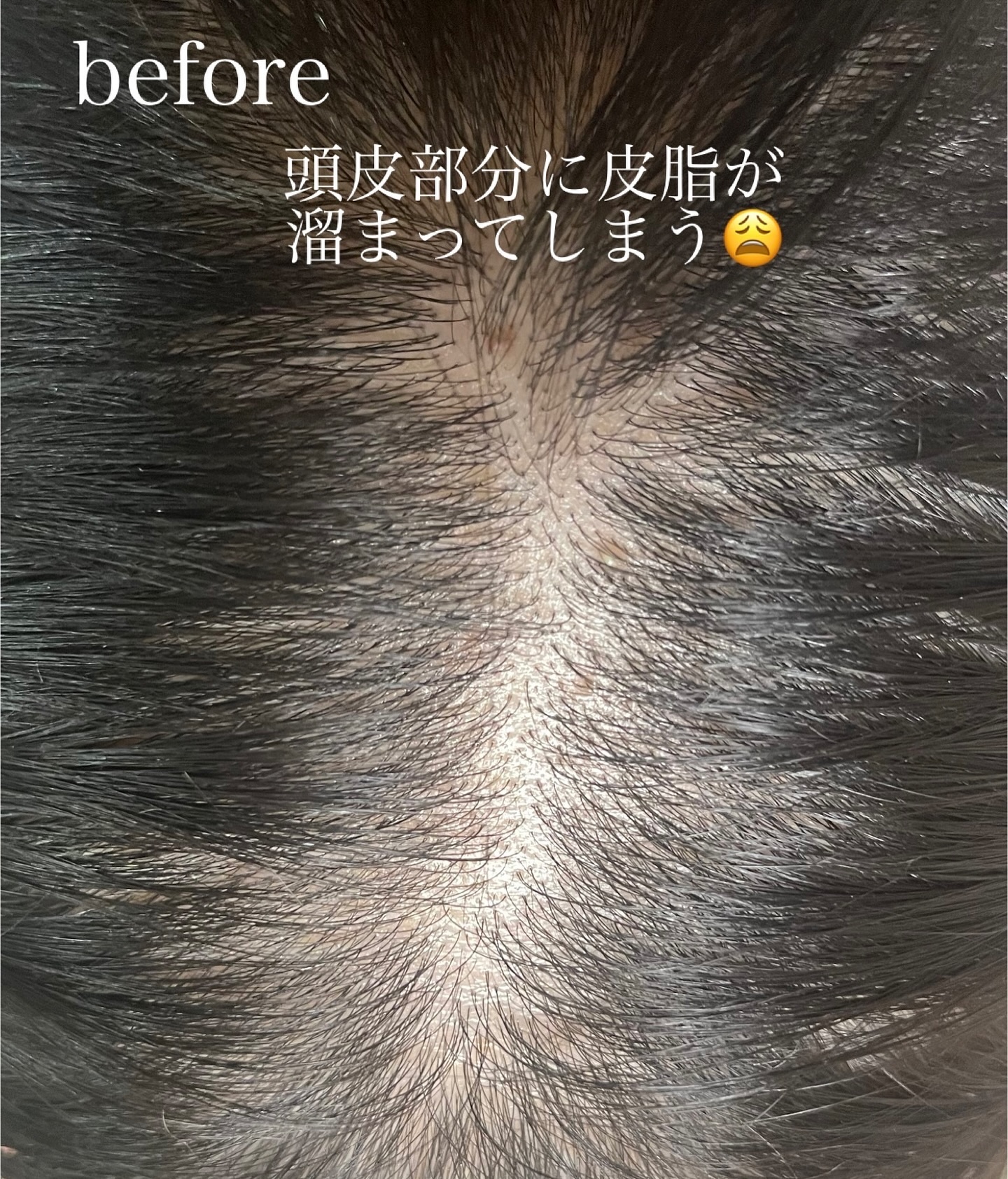 スパークリングスカルプスケーラー/ミンツリー/頭皮ケアを使ったクチコミ（2枚目）