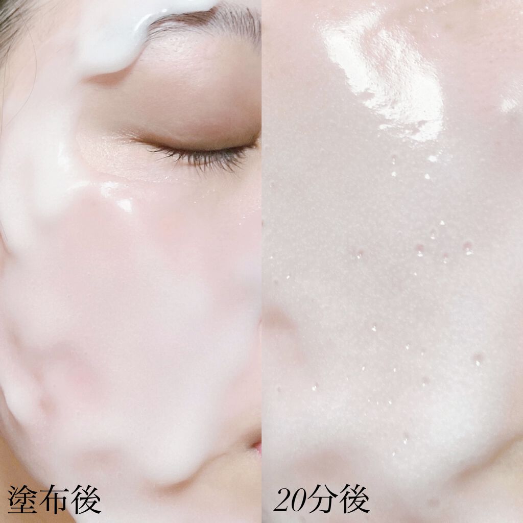 炭酸パック プルリ/ウツクシア/洗い流すパック・マスクを使ったクチコミ(5枚目)