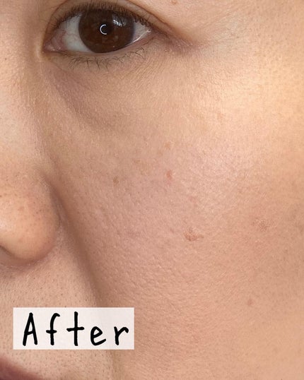 カバーナチュール/アンジエンド/クリームコンシーラーを使ったクチコミ(6枚目)