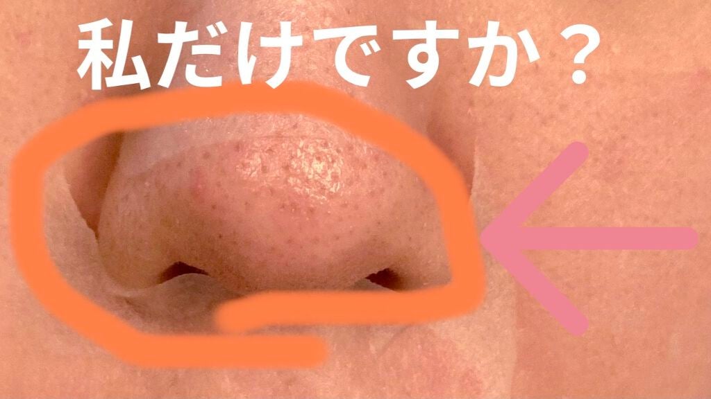 CICA デイリースージングマスク/VT/シートマスク・パックを使ったクチコミ(1枚目)