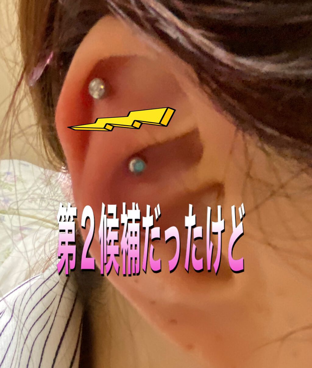 リサ・ラーソン♡クッションファンデマニア on LIPS 「今日は、前回より1週間様子みてからの何事もなく経過した事を確認..」(4枚目)