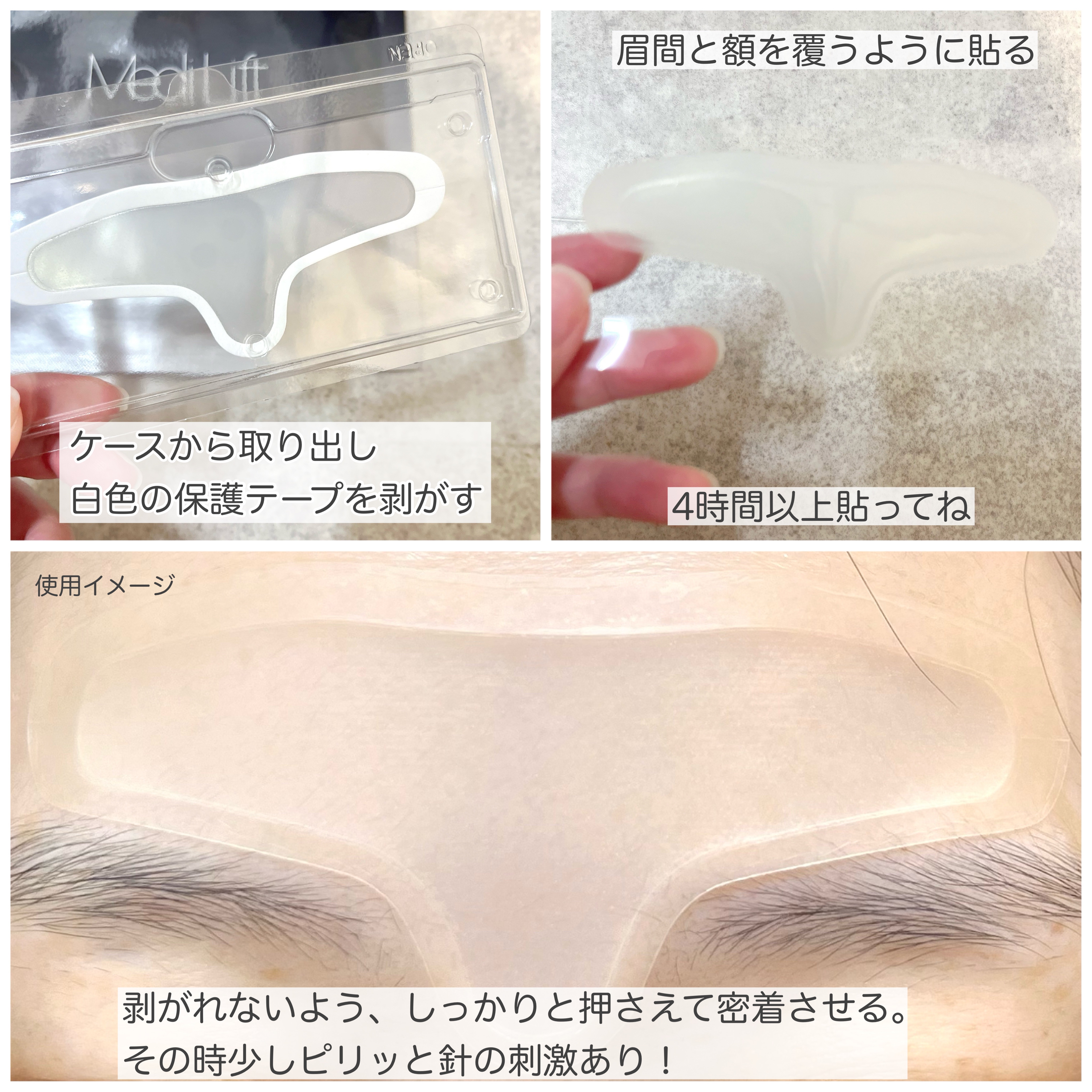 メディリフト マイクロフィラー フォアヘッド/YA-MAN TOKYO JAPAN/頭皮ケアを使ったクチコミ（3枚目）