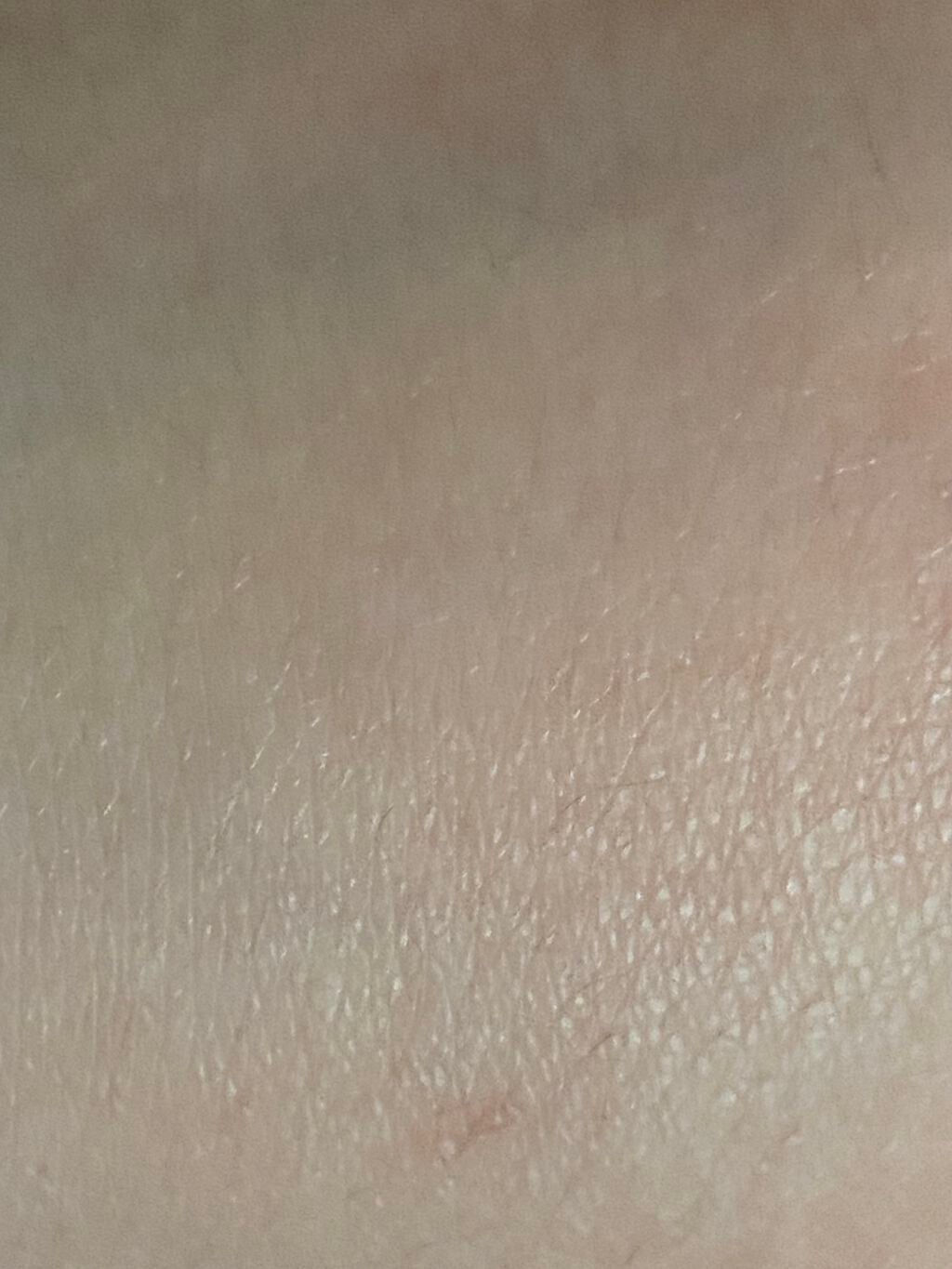 ローズブースターセラム/ROSE LABO/美容液を使ったクチコミ(4枚目)