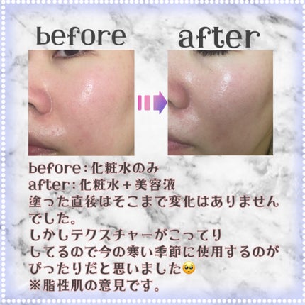 レチノールインテンスリアクティベーションセラム/SOME BY MI/美容液を使ったクチコミ(4枚目)