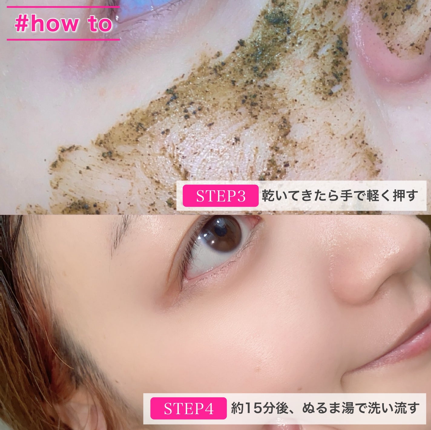 ティーツリーハーブピーリングパック/WellDerma/洗い流すパック・マスクを使ったクチコミ(6枚目)