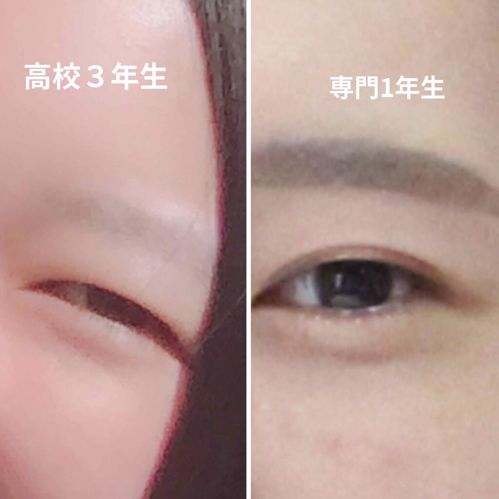 アイビューティー フィクサー WP/アストレア ヴィルゴ/二重まぶた用アイテムを使ったクチコミ（2枚目）