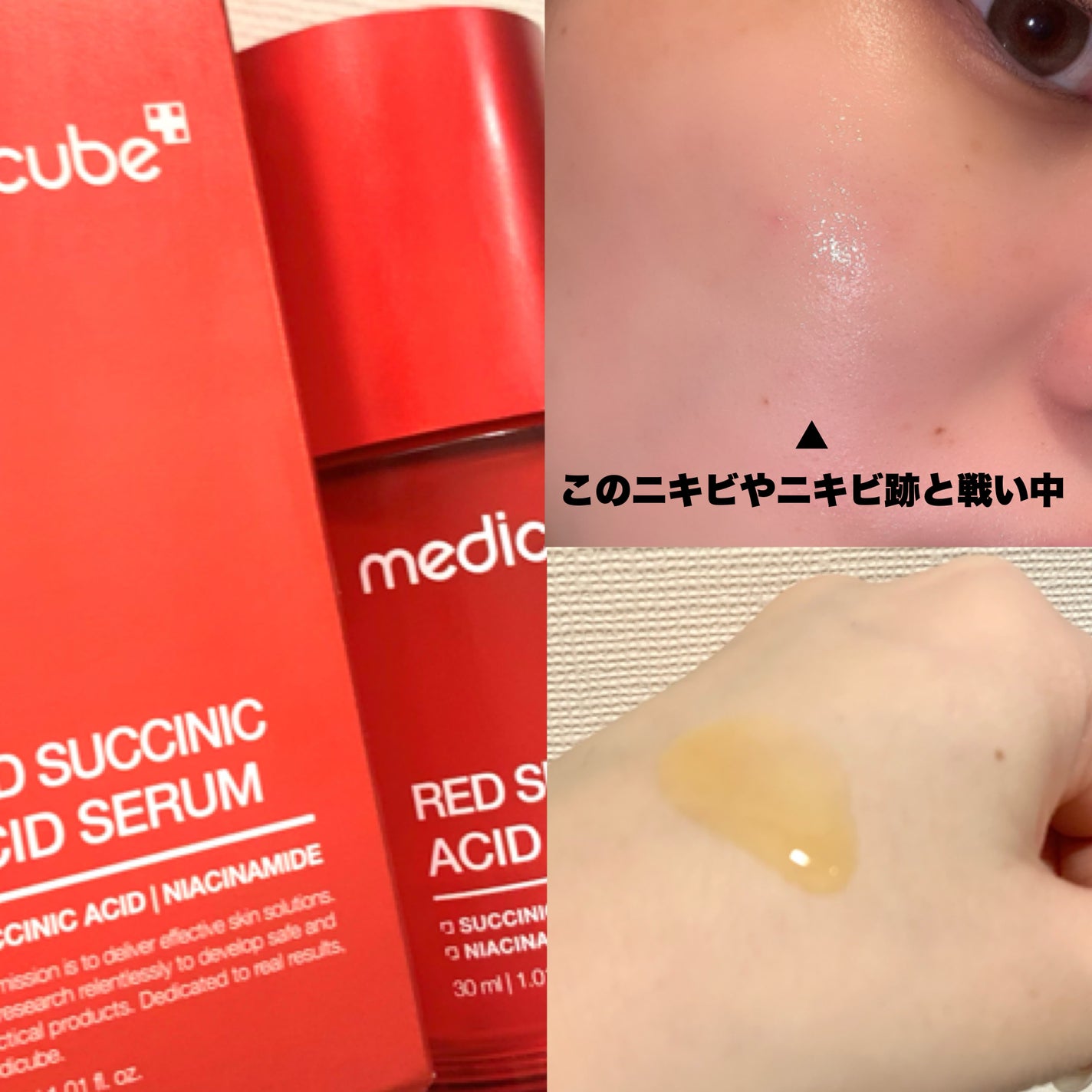 レッドアクネセラム/MEDICUBE/美容液を使ったクチコミ(3枚目)