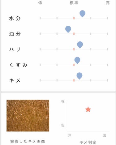 オルビス リンクルホワイトエッセンスのクチコミ「オルビスにフラフラと立ち寄った際に、
肌診断してもらいました。


意外に





マシだっ.....」（3枚目）