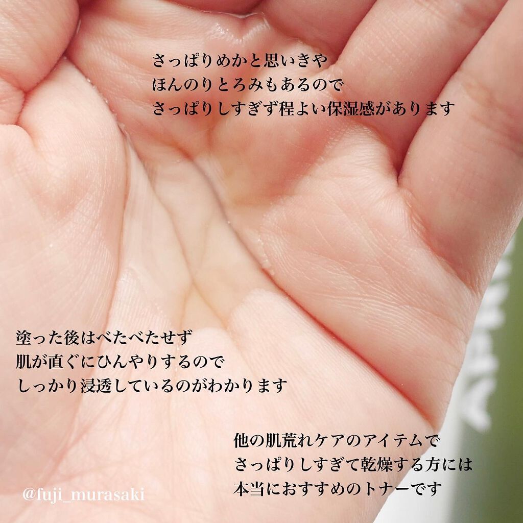 ヨモギエッセンストナー/APRILSKIN/化粧水を使ったクチコミ(3枚目)