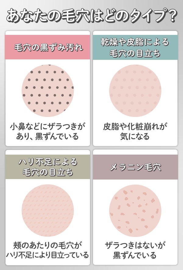 あなたの毛穴はどのタイプ? 毛穴の黒ずみ汚れ・乾燥・皮脂による毛穴の目立ち・ハリ不足による毛穴の目立ち・メラニン毛穴。