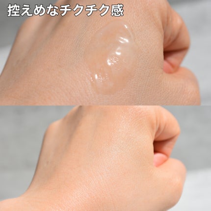 マイルドリードルショット50/VT/美容液を使ったクチコミ(2枚目)