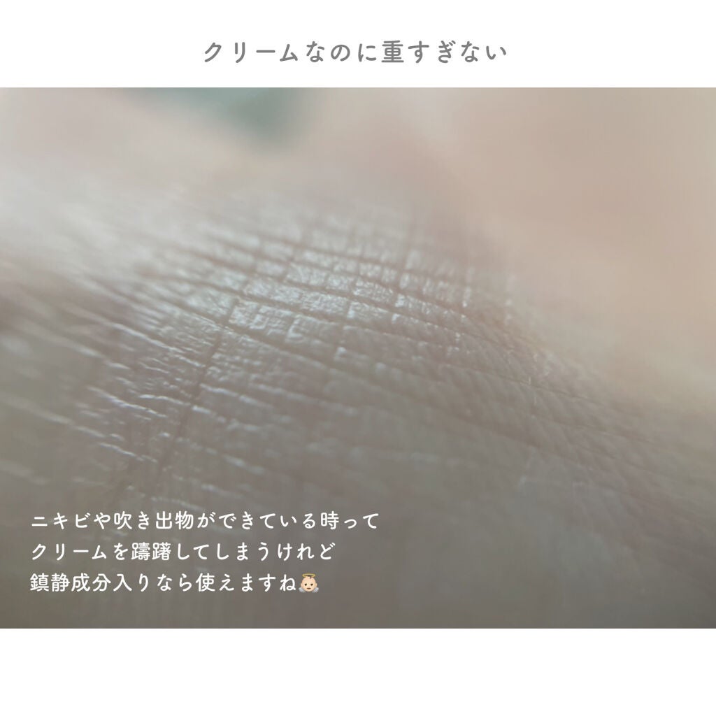 ドクダミ 70 インテンスカーミングクリーム/Anua/フェイスクリームを使ったクチコミ(4枚目)