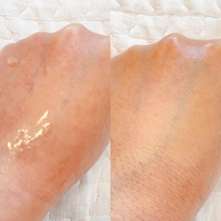 レチノールトナー/APLIN/ミスト状化粧水を使ったクチコミ(2枚目)