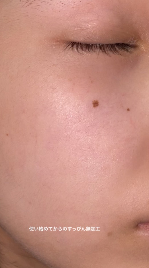 マデカソ 美容液/A’pieu/美容液を使ったクチコミ（2枚目）