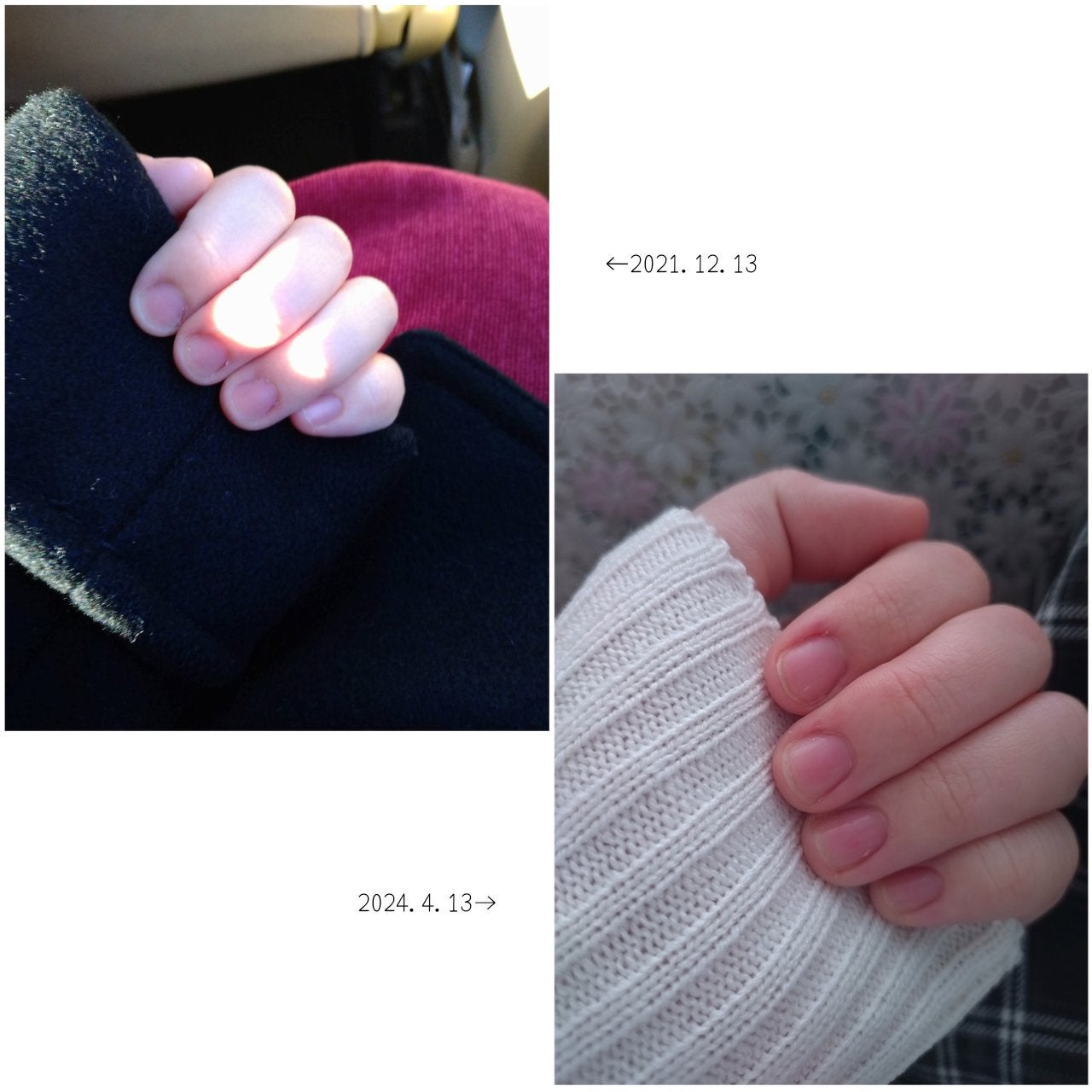 エテュセ クイックケアコート/ettusais/ネイルオイル・トリートメントを使ったクチコミ(1枚目)