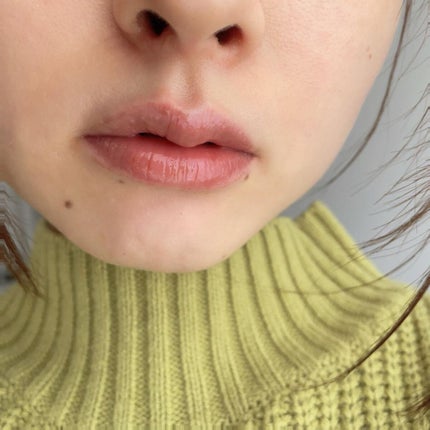 アルブラン リップセラムバーム/ALBLANC/リップバームを使ったクチコミ(2枚目)