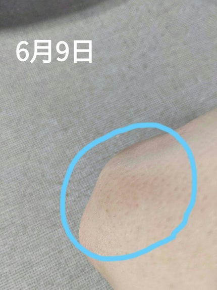 ピュアフェミニンホワイト/ピュアメデル/デリケートゾーンケアを使ったクチコミ(2枚目)