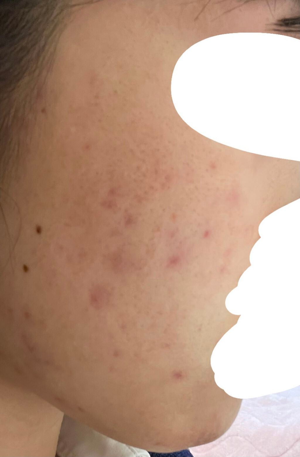 㪠㪠ð§žâ¡ on LIPS ããããæ¥èš2é±éç®2021/02/18ææŽé¡æããŒãããã¹ã¿é..ãïŒ4æç®ïŒ