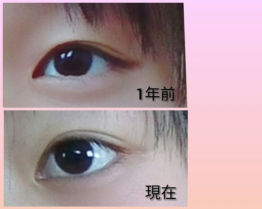 のび〜る アイテープ 両面テープタイプ/DAISO/二重まぶた用アイテムを使ったクチコミ(3枚目)