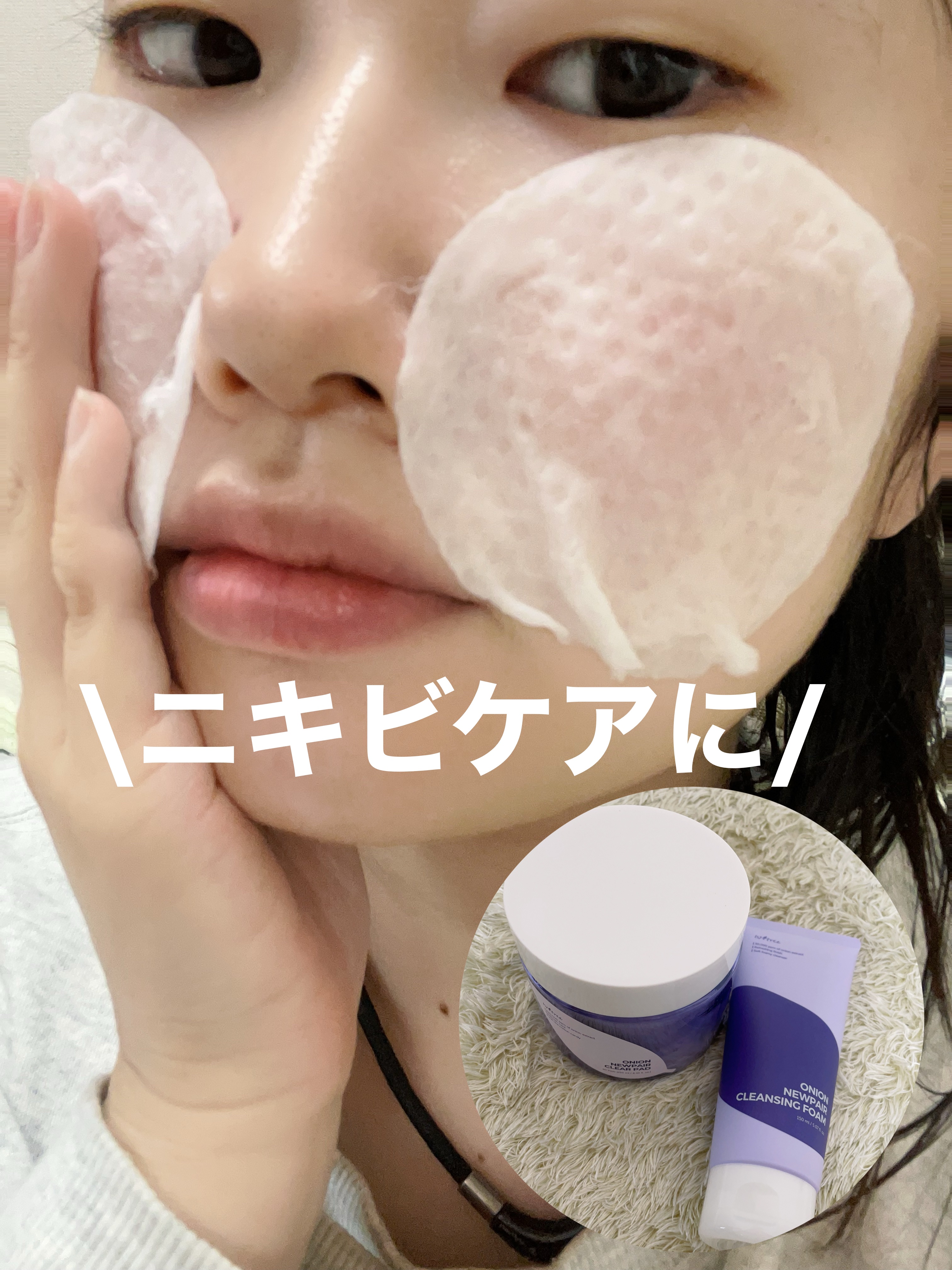 オニオンニューペアクレンジングフォーム/Isntree/洗顔フォームを使ったクチコミ（1枚目）
