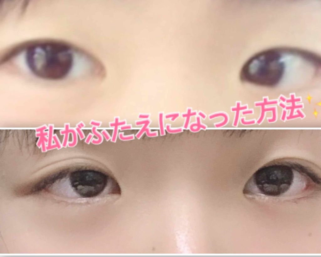 アイテープ 埋没式両面テープ/DAISO/二重まぶた用アイテムを使ったクチコミ(1枚目)