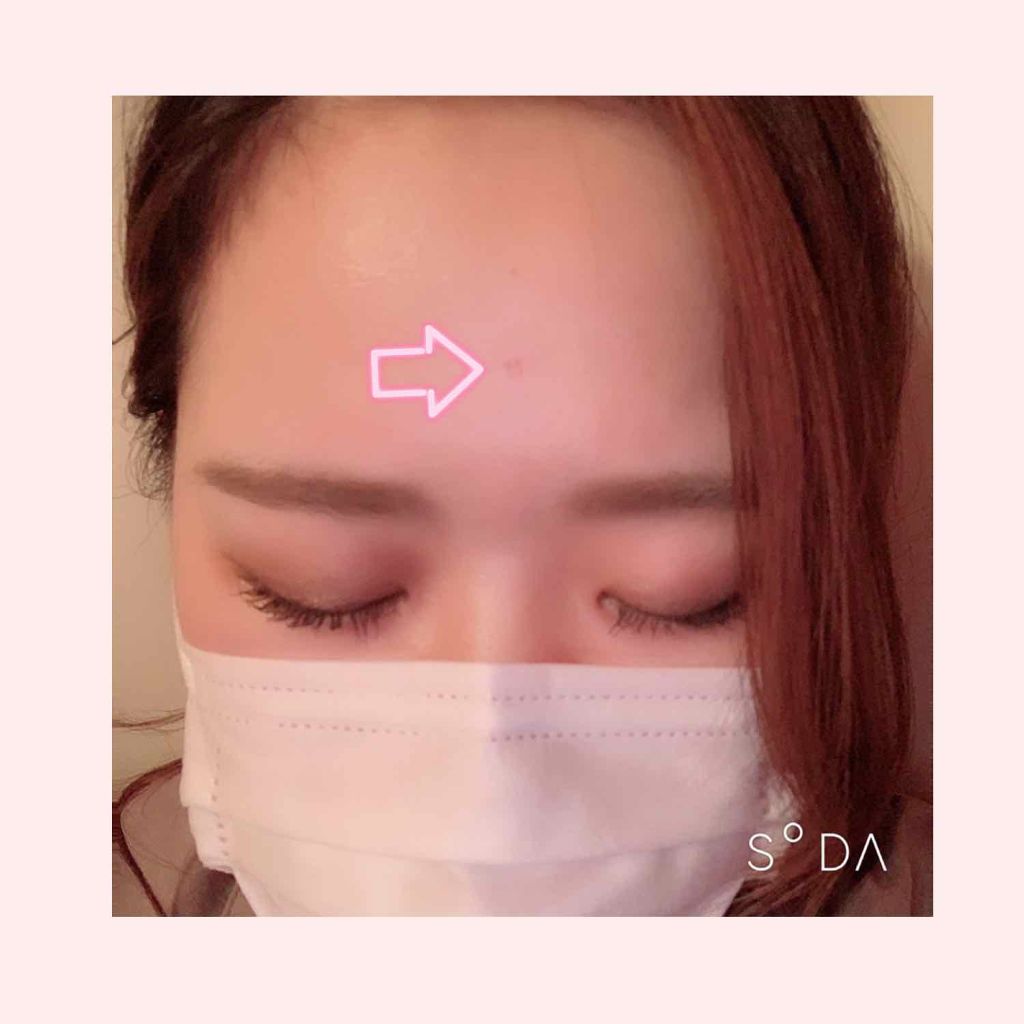 を使ったクチコミ（2枚目）