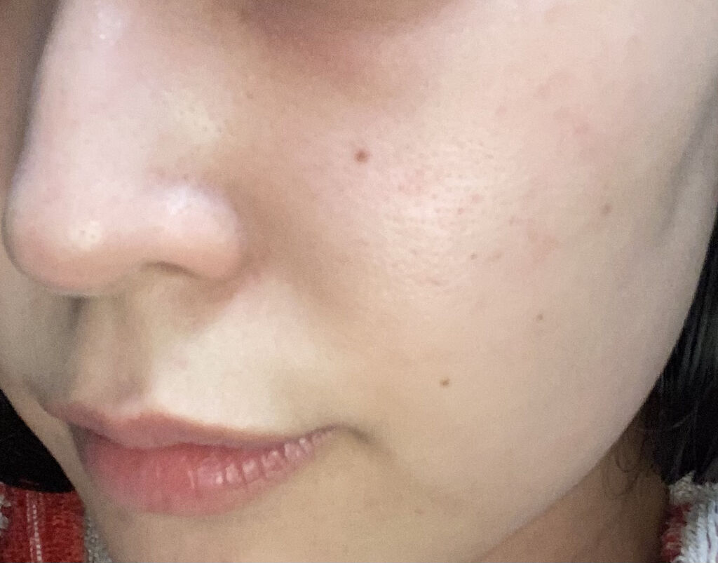 ハトムギ化粧水(ナチュリエ スキンコンディショナー R )/ナチュリエ/化粧水を使ったクチコミ（3枚目）