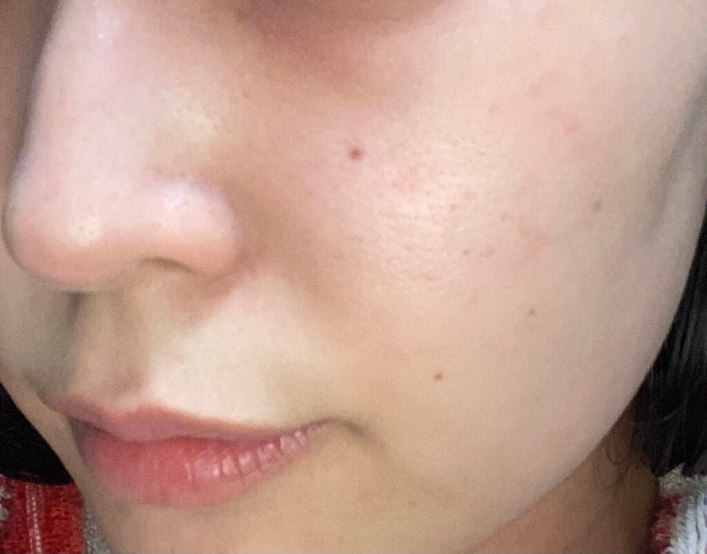 ハトムギ化粧水(ナチュリエ スキンコンディショナー R )/ナチュリエ/化粧水を使ったクチコミ(3枚目)