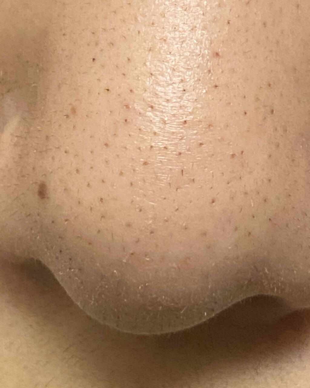 ハトムギ化粧水(ナチュリエ スキンコンディショナー R )/ナチュリエ/化粧水を使ったクチコミ(3枚目)