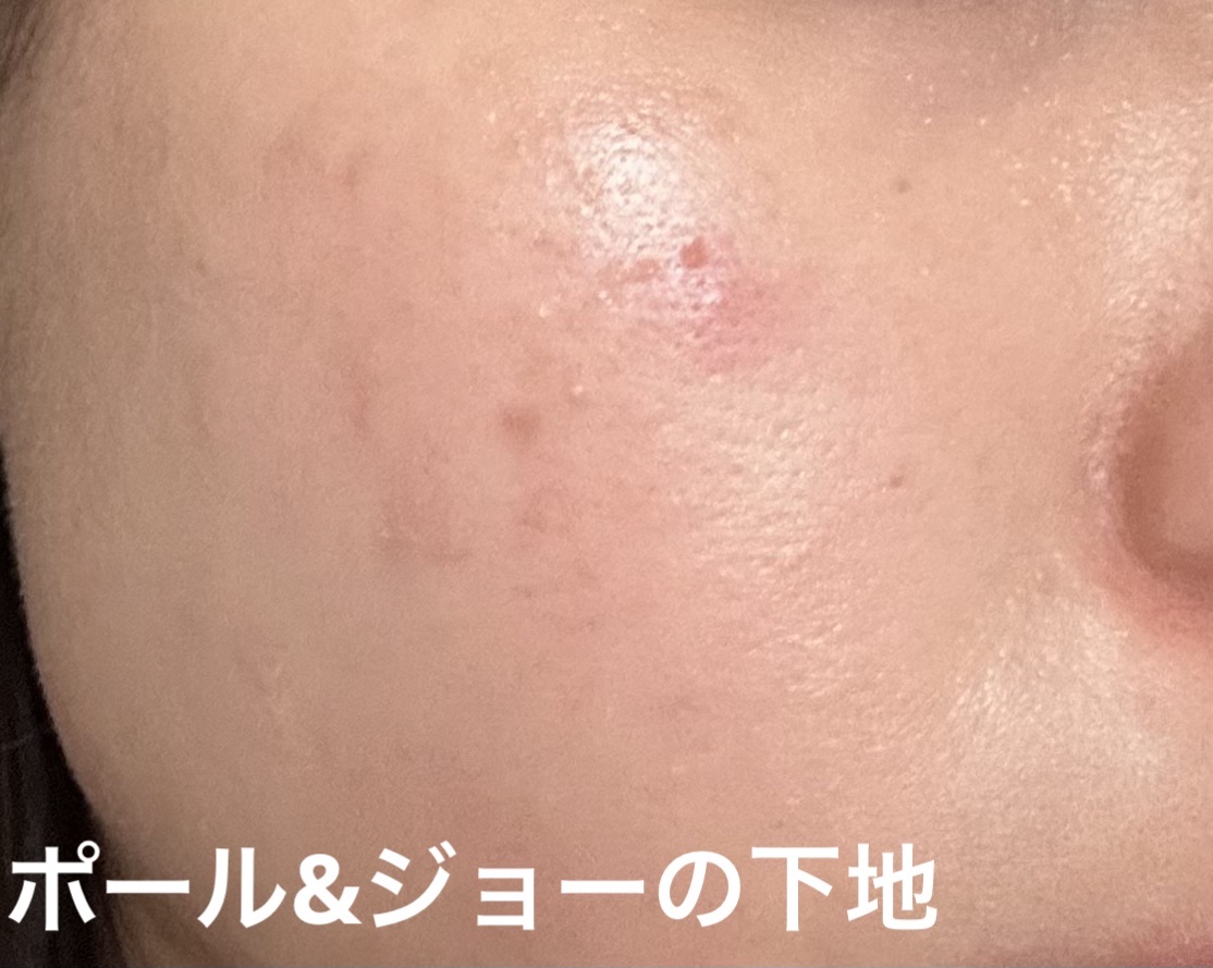 エッセンス スキングロウ ファンデーション/SHISEIDO/リキッドファンデーションを使ったクチコミ（3枚目）