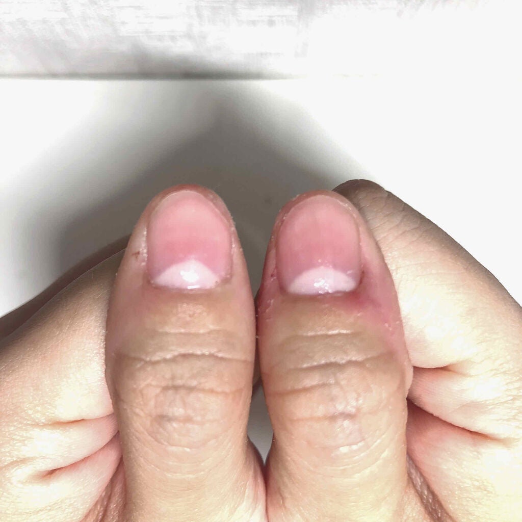 ネイルサポート Na/ネイルネイル/ネイルトップコートを使ったクチコミ(3枚目)