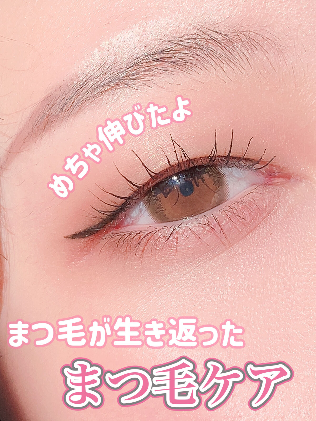 まつ毛が生き返った❕私のまつ毛ケア👀

元々まつ毛の毛量も少なくて長さもほぼなかった私ですが、2年前くらいに右目のまつ毛がめちゃくちゃ抜けちゃってガチ萎えしてから、まつ育を始めました😌

その時にめちゃくちゃ話題になってたのがエマーキッ