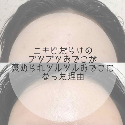 ハトムギ化粧水(ナチュリエ スキンコンディショナー R )/ナチュリエ/化粧水を使ったクチコミ(1枚目)