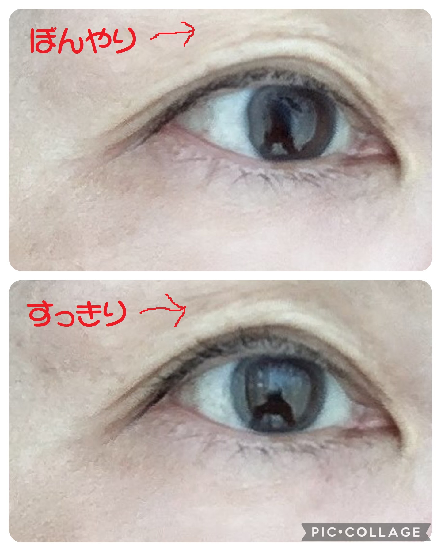 ルドゥーブル プレミアム/ルドゥーブル/二重まぶた用アイテムを使ったクチコミ（2枚目）