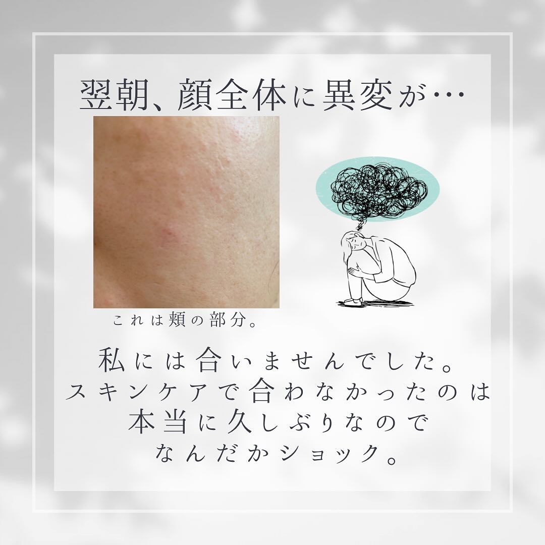 リードルショット100/VT/美容液を使ったクチコミ（3枚目）