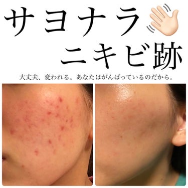 ミネラルリキッドリー ファンデーション SPF22 PA++ 101 アイボリー/MiMC/リキッドファンデーションを使ったクチコミ（1枚目）