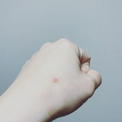 ハニーフルリップ もも色ボリューム/カントリー&ストリーム/リップ美容液を使ったクチコミ(6枚目)