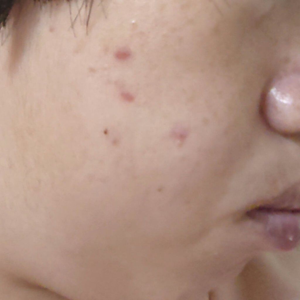 毎日、まなざシートアイマスク EXスムース/EVERYYOU/アイケア・アイクリームを使ったクチコミ（2枚目）