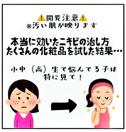 DHC ビタミンCハードカプセル/DHC/美容サプリメントを使ったクチコミ(1枚目)