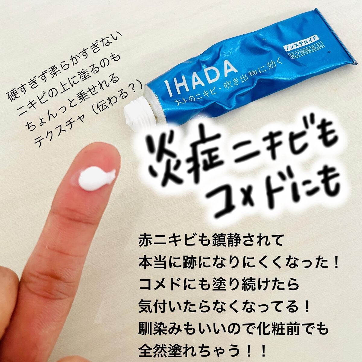 アクネキュアクリーム(医薬品)/IHADA/その他を使ったクチコミ(2枚目)