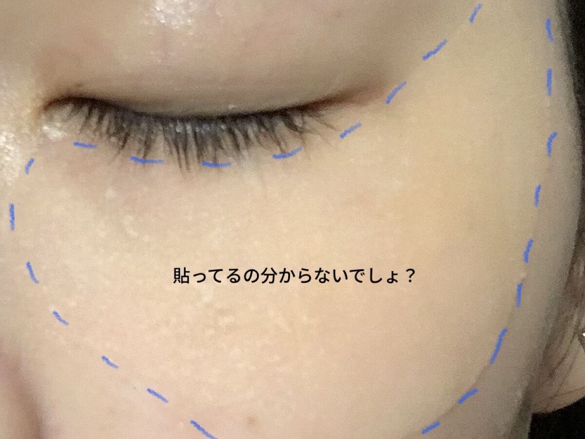 肌ふっくら アイゾーンマスク/クリアターン/シートマスク・パックを使ったクチコミ（2枚目）