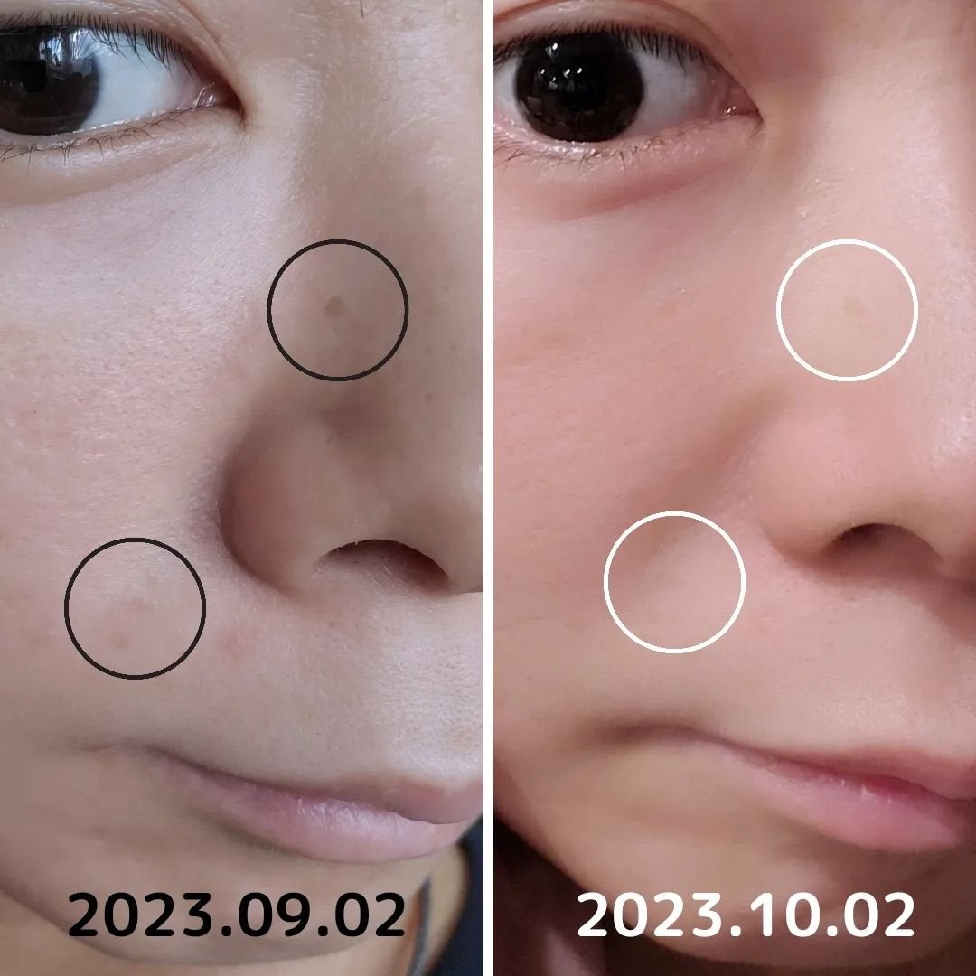 LongLife the VC50NMN+/BE-MAX/美容液を使ったクチコミ(2枚目)